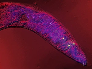 Fluorescence Micrograph Gallery: Caenorhabditis elegans, micrograph