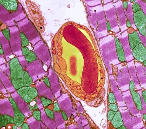 Cardiac muscle and capillary, TEM Cardiac muscle and capillary, TEM