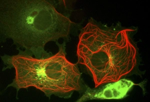 Fluorescence Micrograph Gallery: Cell structure, fluorescent micrograph