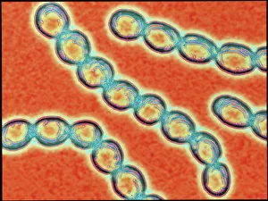 Chains of Streptococcus pyogenes bacteria Chains of Streptococcus pyogenes bacteria