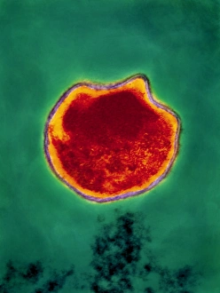 Images Dated 28th October 1994: Chlamydia pneumoniae bacterium