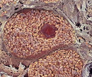 Choroid layer of the eye, SEM