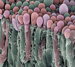 Choroid plexus secretory cells, SEM Choroid plexus secretory cells, SEM
