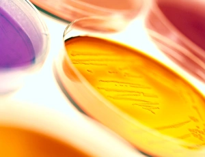 Close-up of petri dishes with bacterial cultures Close-up of petri dishes with bacterial cultures