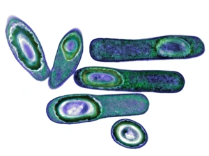 Clostridium difficile bacteria, TEM Clostridium difficile bacteria, TEM