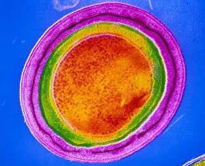 Images Dated 13th November 2002: Clostridium tetani bacterial spore