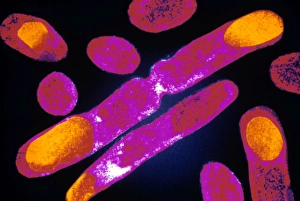 Colour TEM of genetically-altered E. coli bacteria Colour TEM of genetically-altered E. coli bacteria