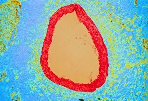 Images Dated 11th April 1996: Coloured LM of a section through a coronary artery
