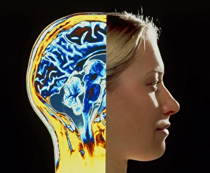 Images Dated 9th July 1996: Coloured MRI scan of brain superimposed on head