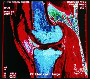 Images Dated 9th October 2003: Coloured MRI scan of human knee joint, side view