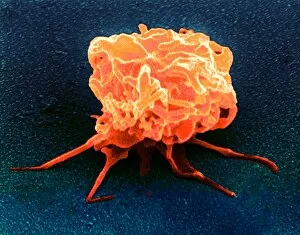Coloured SEM of an activated blood platelet