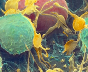 Coloured SEM of activated platelets in human blood Coloured SEM of activated platelets in human blood