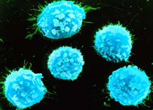 Coloured SEM of B-lymphocyte white blood cells Coloured SEM of B-lymphocyte white blood cells