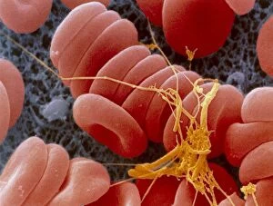 Images Dated 10th March 2005: Coloured SEM of an early blood clot forming
