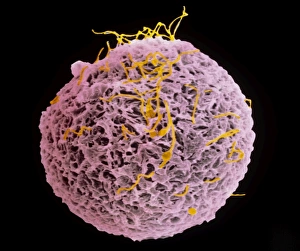 Coloured SEM of egg & sperm during fertilisation Coloured SEM of egg & sperm during fertilisation