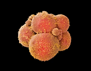 Coloured SEM of human embryo at 8-cell stage Coloured SEM of human embryo at 8-cell stage