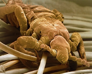 Coloured SEM of a human head louse on hair shafts Coloured SEM of a human head louse on hair shafts