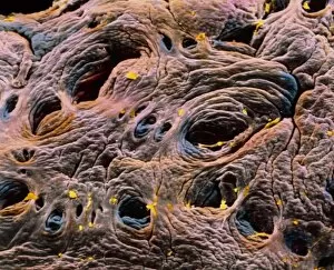 Images Dated 17th October 2003: Coloured SEM of intestine, showing coeliac disease