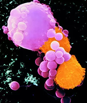 Disorder Gallery: Coloured SEM of lymphocytes attacking cancer cell