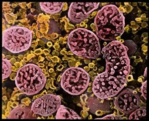 Smooth Gallery: Coloured SEM of mitochondria in ovarian cells