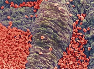 Images Dated 14th December 1999: Coloured SEM of red blood cells on vessel wall