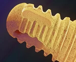 Images Dated 10th September 2003: Coloured SEM of the root of a dental implant