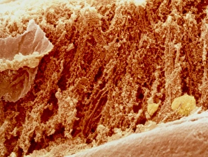 Coloured SEM of section through well-cooked meat Coloured SEM of section through well-cooked meat