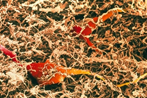 Cell Body Gallery: Coloured SEM of spinal cord nerve cells