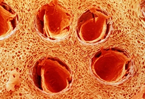 Coloured SEM of trichomes in orange peel Coloured SEM of trichomes in orange peel