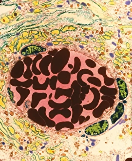 Coloured TEM of a blood vessel in the spinal cord Coloured TEM of a blood vessel in the spinal cord