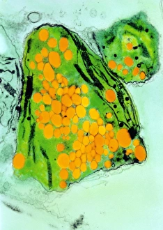 Coloured TEM of cress chloroplast growing plastic Coloured TEM of cress chloroplast growing plastic