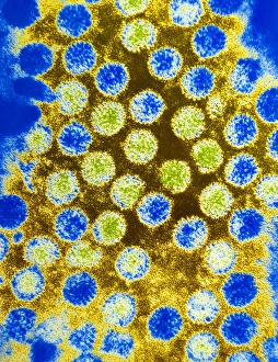 Images Dated 25th April 1992: Coloured TEM of rotaviruses