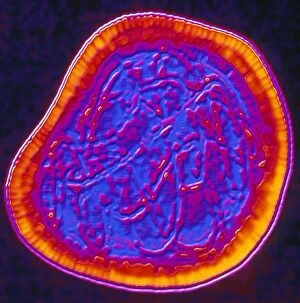 Images Dated 9th August 2002: Coloured TEM of a rubella (German measles) virus