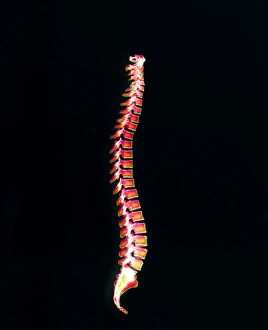 Coloured X-ray of a healthy human spine Coloured X-ray of a healthy human spine