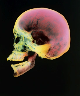 Coloured X-ray of a human skull seen from the side Coloured X-ray of a human skull seen from the side