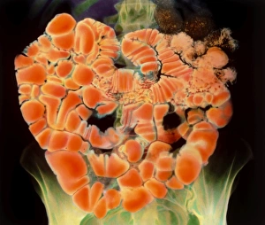 Coloured X-ray of the human small intestine Coloured X-ray of the human small intestine