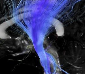 Central Nervous System Gallery: Corticospinal tract, DTI MRI scan C017 / 7046