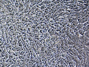 Stem Cell Gallery: Cystic fibrosis stem cells