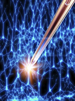 Deep brain stimulation and nerve cells C016/7200 Deep brain stimulation and nerve cells C016/7200