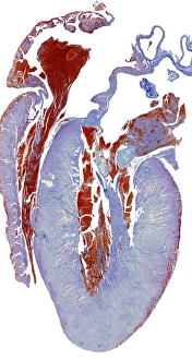 Dissected heart, light micrograph Dissected heart, light micrograph