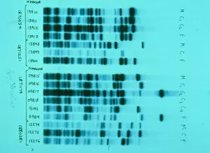 Images Dated 19th August 2002: DNA fingerprinting