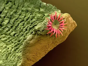Dog tapeworm, SEM Dog tapeworm, SEM