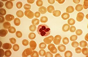 Light Microscope Gallery: Dohle bodies in blood cell, micrograph