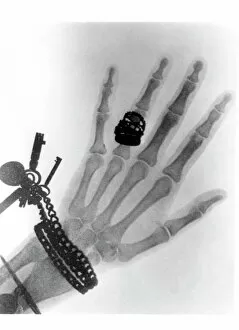 Early X-ray photograph of a hand taken in 1896