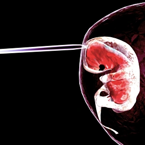 Stem Cell Gallery: Embryo research