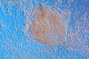Differentiation Gallery: Embryoid bodies, light micrograph