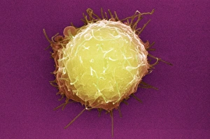Stem Cell Gallery: Embryonic stem cell, SEM