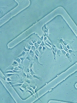 Differentiation Gallery: Embryonic stem cells in culture