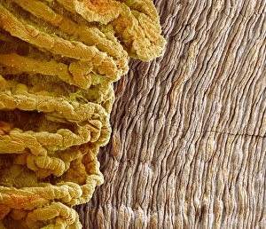 Eye anatomy, SEM