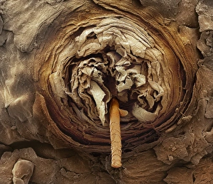 Eyelash follicle, SEM